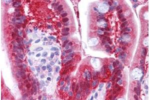 Human Small Intestine: Formalin-Fixed, Paraffin-Embedded (FFPE)