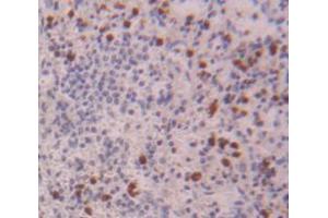 IHC-P analysis of Kidney tissue, with DAB staining. (NCF4 anticorps  (AA 132-339))
