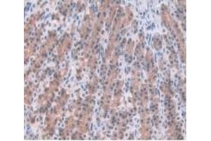 Detection of a1AGP in Rat Stomach Tissue using Monoclonal Antibody to Alpha-1-Acid Glycoprotein (a1AGP)