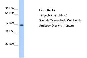 Host: Rabbit Target Name: LPPR3 Sample Type: Hela Whole Cell lysates Antibody Dilution: 1.