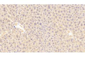 Detection of ROR1 in Mouse Liver Tissue using Polyclonal Antibody to Receptor Tyrosine Kinase Like Orphan Receptor 1 (ROR1)