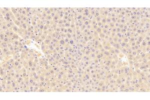 Detection of ROR1 in Mouse Liver Tissue using Polyclonal Antibody to Receptor Tyrosine Kinase Like Orphan Receptor 1 (ROR1) (ROR1 anticorps  (AA 470-707))