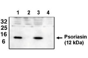 Image no. 1 for anti-S100 Calcium Binding Protein A7 (S100A7) antibody (ABIN264929) (S100A7 anticorps)
