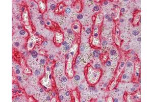 Anti-GLUT2 antibody IHC of human liver.