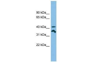 RRAGC antibody used at 1 ug/ml to detect target protein. (GTR2 anticorps  (N-Term))