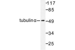 Image no. 1 for anti-Tubulin, alpha 1B (TUBA1B) antibody (ABIN272103) (TUBA1B anticorps)