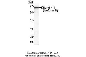 Image no. 1 for anti-Erythrocyte Membrane Protein Band 4.1 Like 3 (EPB41L3) (AA 400-500), (Internal Region) antibody (ABIN363626)
