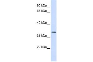 Western Blotting (WB) image for anti-F-Box Protein 25 (FBXO25) antibody (ABIN2458708)