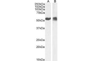 Western Blot using anti-p53 antibody PAb42. (Recombinant p53 anticorps  (AA 371-380))