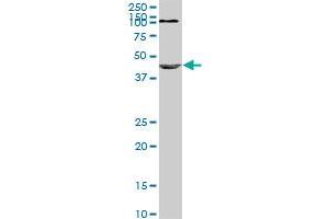 NODAL monoclonal antibody (M03), clone 5C3.