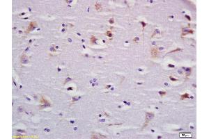 Formalin-fixed and paraffin embedded rat brain labeled with Anti-BBS9 Polyclonal Antibody, Unconjugated (ABIN1387812) at 1:200 followed by conjugation to the secondary antibody and DAB staining (BBS9 anticorps  (AA 244-320))