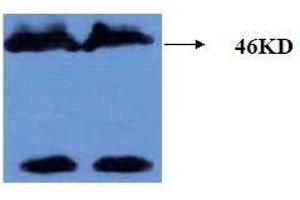 Western Blotting (WB) image for anti-Microtubule-Associated Protein tau (MAPT) (AA 177-187), (pThr181) antibody (ABIN1108152) (MAPT anticorps  (pThr181))