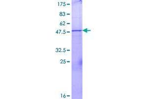Image no. 1 for Ubiquitin-Conjugating Enzyme E2U (UBE2U) (AA 1-226) protein (GST tag) (ABIN1324408)
