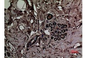 Immunohistochemistry (IHC) analysis of paraffin-embedded Human Breast, antibody was diluted at 1:100.