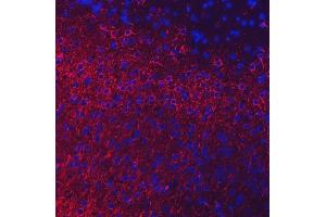 IF analysis of NEFL/NF-L using anti-NEFL/NF-L antibody (ABIN7601626).