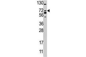 Western blot analysis of SMURF2 polyclonal antibody  in 293 cell line lysate (35 ug/lane). (SMURF2 anticorps  (AA 702-731))
