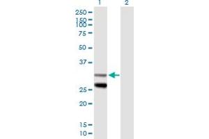 Western Blot analysis of SCO1 expression in transfected 293T cell line by SCO1 MaxPab polyclonal antibody. (SCO1 anticorps  (AA 1-301))