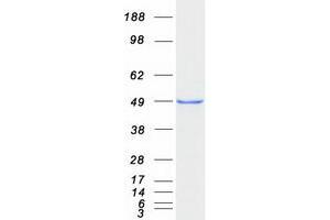 Validation with Western Blot