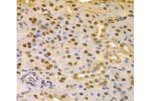 Immunohistochemistry of paraffin-embedded Rat kidney using COPS5 Polyclonal Antibody at dilution of 1:100 (40x lens). (COPS5 anticorps)