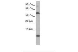 Image no. 1 for anti-Ligand Dependent Nuclear Receptor Corepressor (Lcor) (N-Term) antibody (ABIN6736069) (Lcor anticorps  (N-Term))