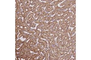 Immunohistochemical staining of human liver with OAF polyclonal antibody  shows strong cytoplasmic positivity in hepatocytes. (OAF anticorps)