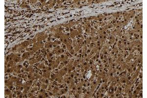 ABIN6278751 at 1/100 staining Human liver tissue by IHC-P. (CT47A1 anticorps)