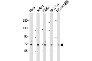 All lanes : Anti-NUP85 Antibody (N-Term) at 1:2000 dilution Lane 1: Hela whole cell lysate Lane 2: Jurkat whole cell lysate Lane 3: K562 whole cell lysate Lane 4: MOLT-4 whole cell lysate Lane 5: NCI- whole cell lysate Lysates/proteins at 20 μg per lane. (NUP85 anticorps  (AA 163-195))