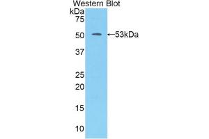 Western blot analysis of the recombinant protein. (Kallikrein 7 anticorps  (AA 23-253))