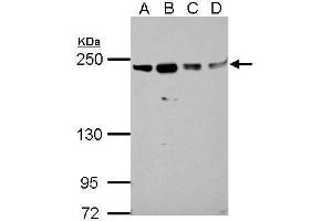 WB Image Sample (30 ug of whole cell lysate) A: A549 B: H1299 C: HCT116 D: MCF-7 5% SDS PAGE antibody diluted at 1:1000 (SLK anticorps)