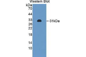 Western blot analysis of the recombinant protein.