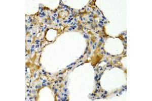 Immunohistochemistry of paraffin-embedded rat lung using IL9 antibody (ABIN3015677, ABIN3015678, ABIN1680463 and ABIN6219030) at dilution of 1:200 (40x lens). (IL-9 anticorps  (AA 19-144))