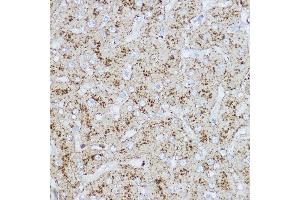 Immunohistochemistry of paraffin-embedded human liver using L Rabbit pAb (ABIN6129969, ABIN6143081, ABIN6143082 and ABIN6218224) at dilution of 1:200 (40x lens). (LAMP2 anticorps  (AA 30-300))