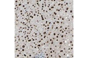 Immunohistochemical staining of human liver with USP36 polyclonal antibody  shows strong nuclear positivity in hepatocytes at 1:20-1:50 dilution. (USP36 anticorps)