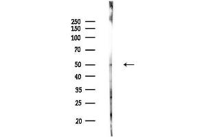 Western blot analysis of lysates from MCF7 cells(heat-shock,45 min treatment), using PKA beta Antibody at 1/1000 dilution.