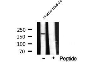 Western blot analysis on mouse muscle lysate using TOP2A Antibody (Topoisomerase II alpha anticorps  (Internal Region))