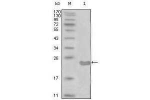 Western blot analysis using CD10 mouse mAb against truncated CD10-His recombinant protein (1). (MME anticorps)