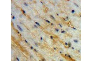 IHC-P analysis of Heart tissue, with DAB staining. (PCOLCE anticorps  (AA 38-449))