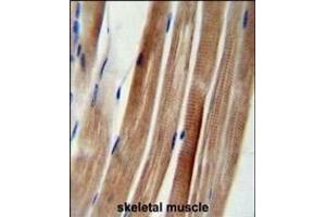 KI Antibody (Center) (ABIN654704 and ABIN2844396) immunohistochemistry analysis in formalin fixed and paraffin embedded human skeletal muscle followed by peroxidase conjugation of the secondary antibody and DAB staining. (KANSL3 anticorps  (AA 398-427))
