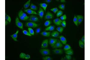 Immunofluorescence staining of Hela cells with ABIN7158919 at 1:166, counter-stained with DAPI. (MFSD4 anticorps  (AA 160-220))