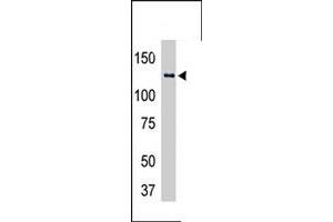 The USP25 polyclonal antibody  is used in Western blot to detect USP25-transfected HeLa cell lysates . (USP25 anticorps  (C-Term))