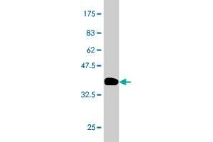 Western Blot detection against Immunogen (36. (TRIM33 anticorps  (AA 1006-1105))
