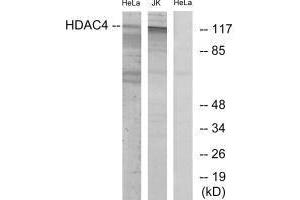 Western blot analysis of extracts from HeLa/Jurkat cells, using HDAC4 (Ab-632) antibody.