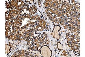 IHC analysis of IRBIT/AHCYL1 using anti-IRBIT/AHCYL1 antibody (ABIN7600030). (AHCYL1 anticorps  (AA 14-57))