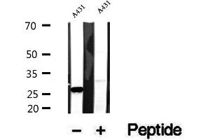 Western blot analysis of extracts of A431 cells, using CHCHD3 antibody. (CHCHD3 anticorps  (N-Term))