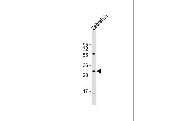 HOXD11 抗体  (AA 128-155)