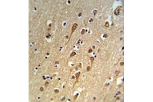 anti-Upregulator of Cell Proliferation (URGCP) (AA 473-503), (Middle Region) antibody