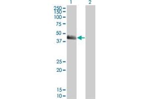 Western Blot analysis of SERPINE1 expression in transfected 293T cell line by SERPINE1 monoclonal antibody (M01), clone 3F2. (PAI1 anticorps  (AA 86-185))