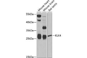 Western blot analysis of extracts of various cell lines, using KLK4 Antibody (ABIN6131853, ABIN6142954, ABIN6142955 and ABIN6222339) at 1:1000 dilution. (Kallikrein 4 anticorps  (AA 30-254))