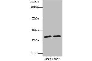 Western blot All lanes: APIPantibody at 1. (APIP anticorps  (AA 1-242))