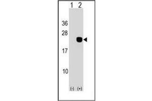 Western blot analysis of DCTD (arrow) using DCTD Antibody (N-term) Cat. (DCMP Deaminase (DCTD) (AA 1-30), (N-Term) anticorps)